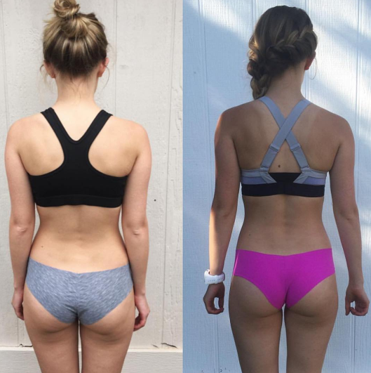 Kayla Itsines