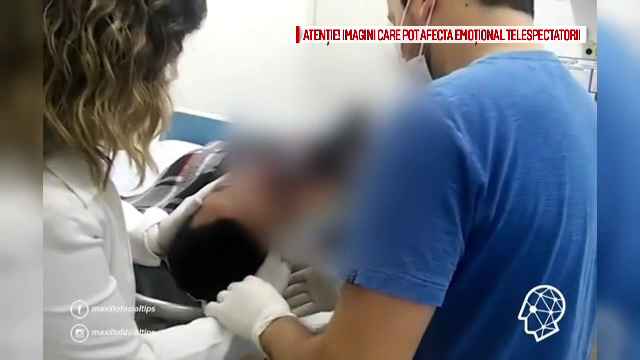 Un brazilian a ajuns la spital cu un cutit in falca, in urma unei incaierari. Momentul in care medicul i l-a scos. VIDEO