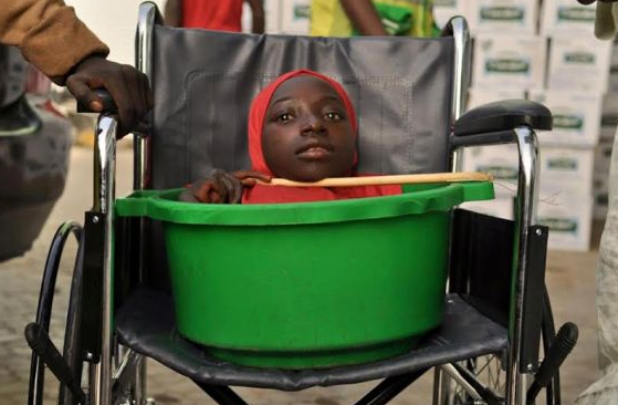 Adolescenta care traia intr-un lighean si a uimit o lume intreaga a murit. La 19 ani, avea corpul unui bebelus