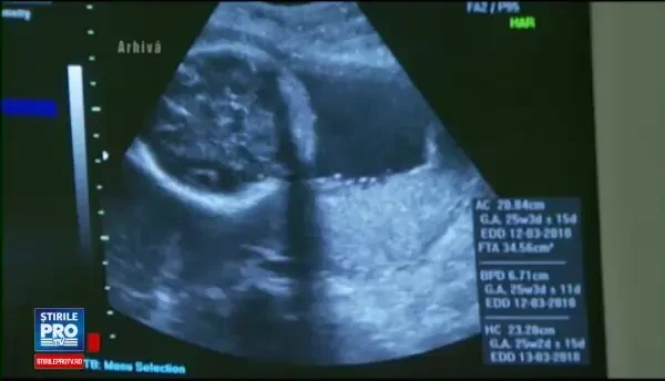 Ancheta in Piatra Neamt dupa ce gemeni nascuti prematur au contactat infectii intraspitalicesti. Un bebelus a murit