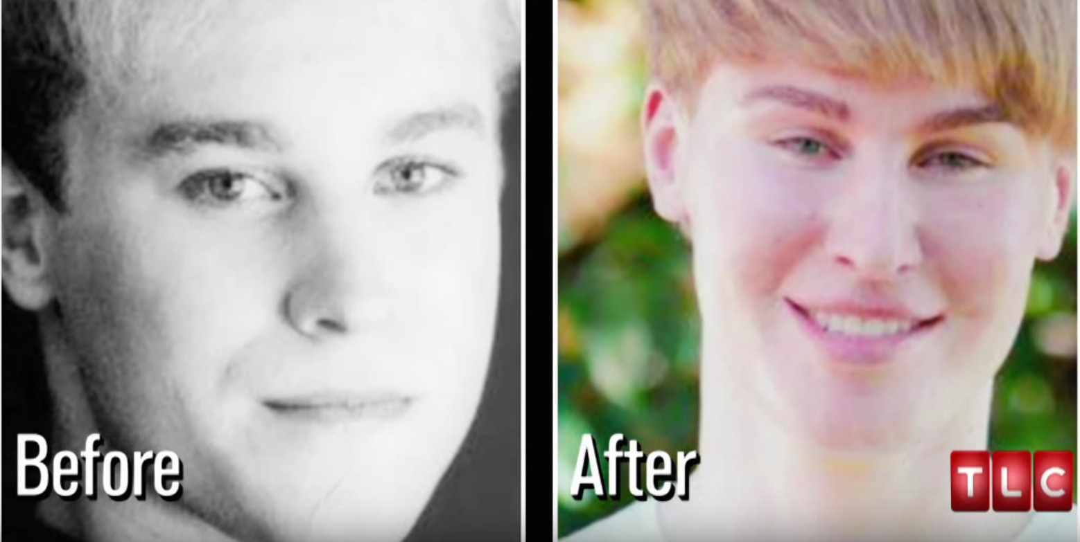 A murit dupa ce a cheltuit o suma uriasa ca sa arate ca Justin Bieber. Care a fost cauza decesului