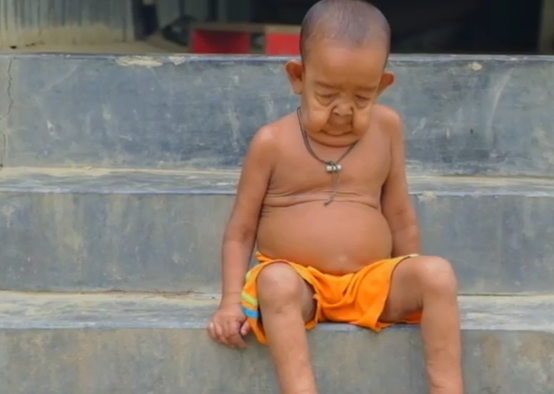 Baiatul de 4 ani care arata ca un batran. Mama: "La 3 luni avea deja un set complet de dinti". VIDEO