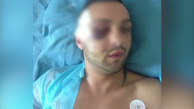 Luptator de kickboxing din Timisoara, batut cu bestialitate in fata iubitei. Unde erau cei doi
