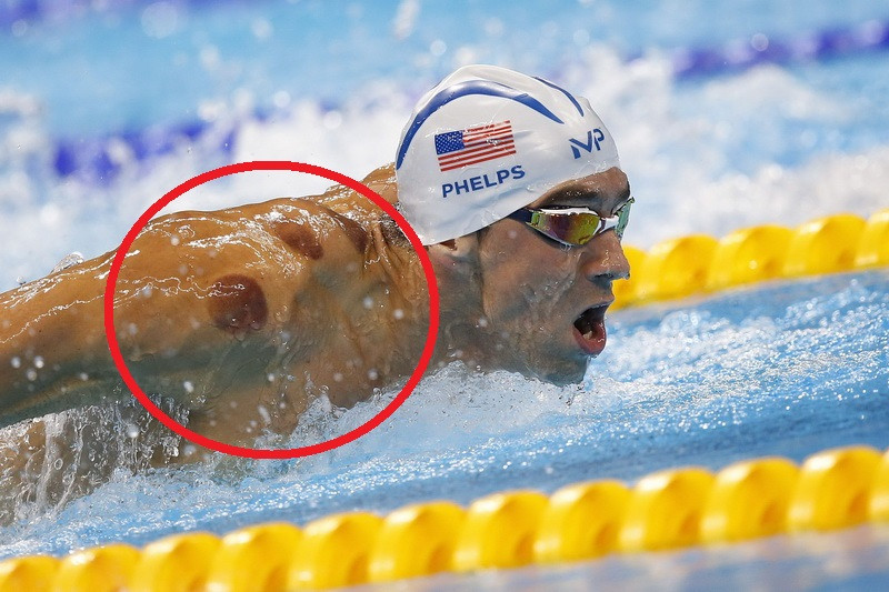 Misterul a fost elucidat. Ce reprezinta de fapt urmele de pe corpul sportivilor americani: "Ma scuteste de multa durere"