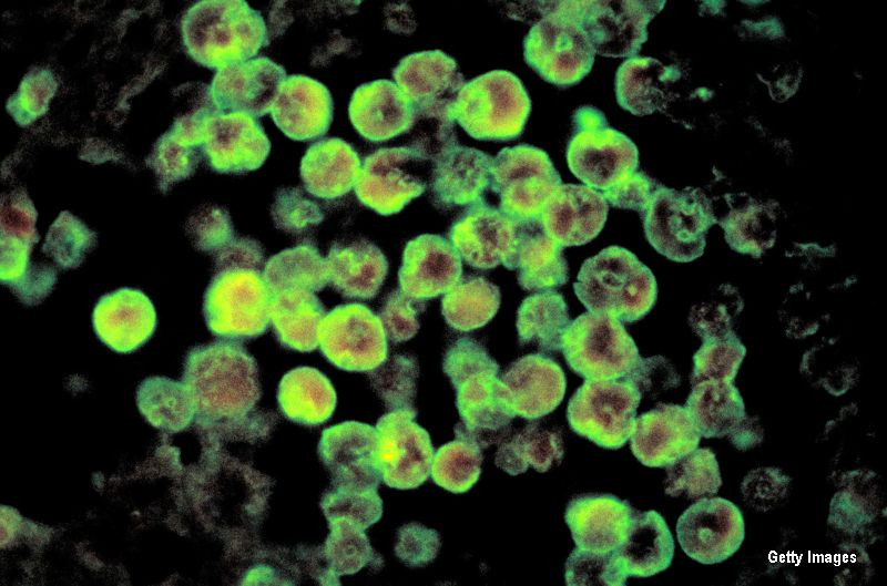 American, infectat cu un tip de amiba care ataca creierul. Doi copii au murit in aceasta vara dupa ce au contractat infectia