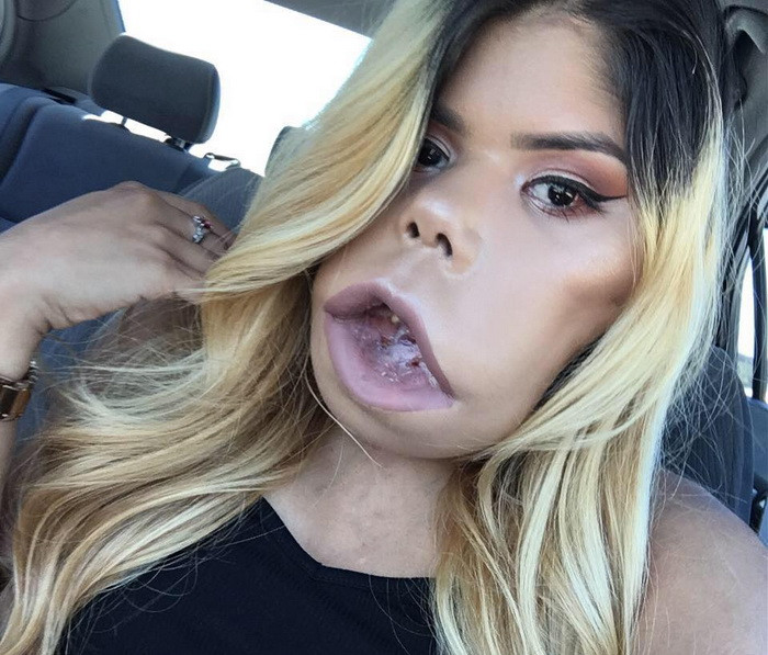 S-a nascut cu o tumoare pe fata, dar are un hobby care uimeste pe toata lumea. Imaginile vizualizate de milioane de ori