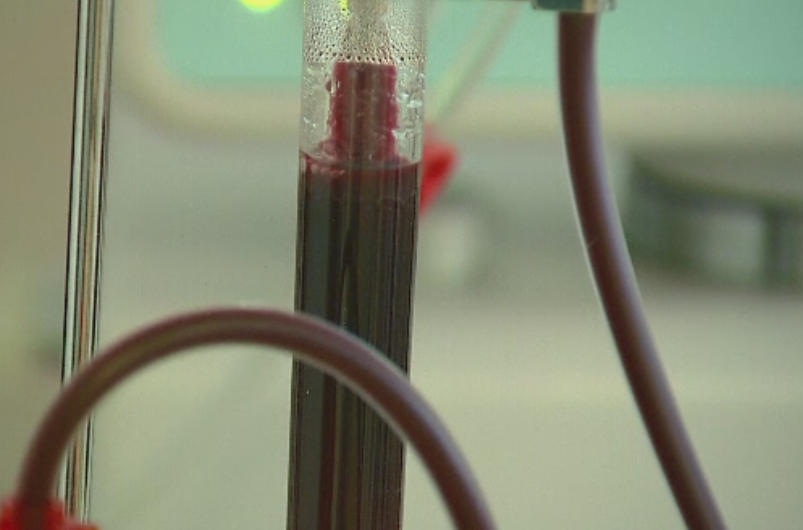 Pacienta care a primit o transfuzie de sange gresita la Spitalul CF2, externata. Ce spune sotul femeii despre despagubiri