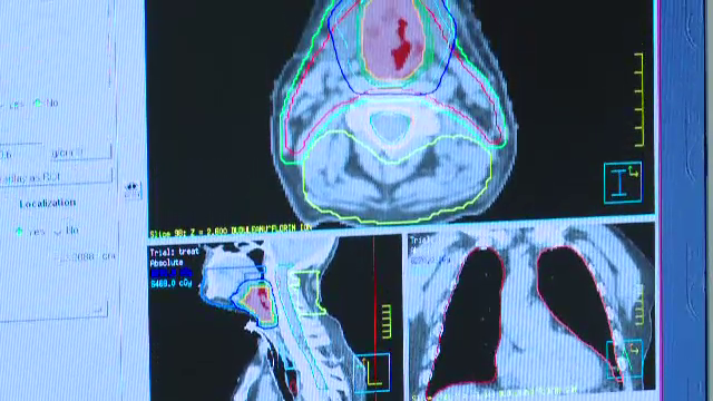 Protocolul prin care ar trebui tratat corect cancerul si care sporeste sansele la viata. In Romania, este respectat rar