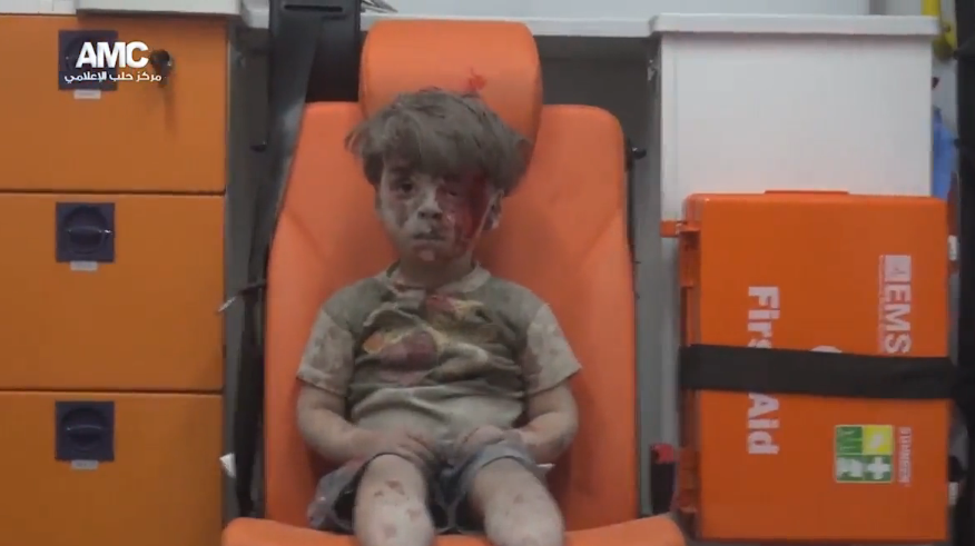 Omran a iesit din spital dupa ce ranile i-au fost curatate. Medic: "Nici macar nu a putut sa planga, asa era de socat"