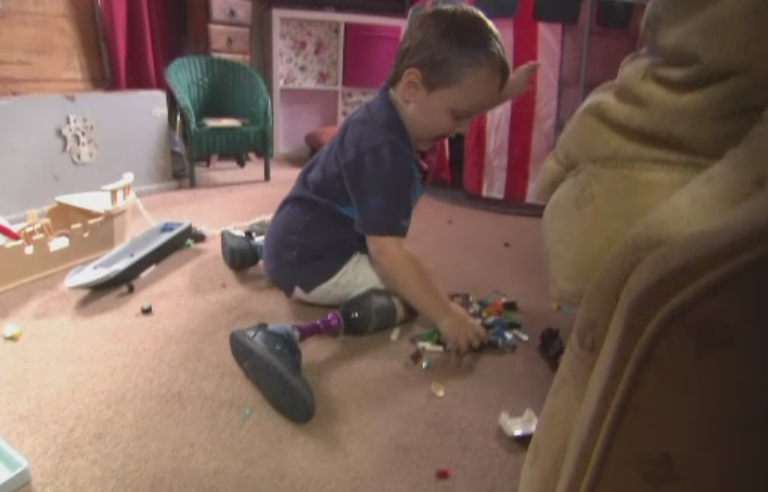 Urmarile dramatice ale unui caz de malpraxis din M. Britanie. Un baietel de 3 ani a ramas fara picioare din cauza septicemiei