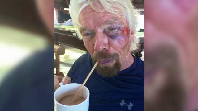 Miliardarul britanic Richard Branson, ranit intr-un accident de bicicleta. "Bine ca purtam casca de protectie"