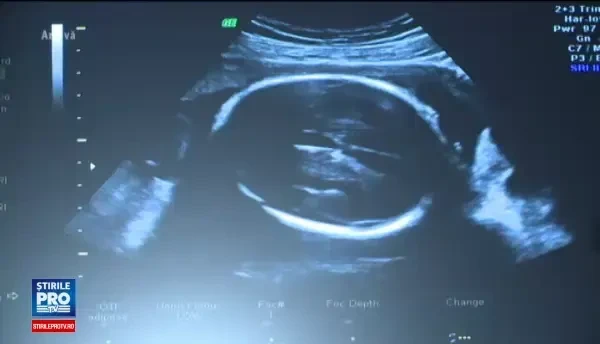 Ce efecte ar putea avea paracetamolul luat in timpul sarcinii. Producatorii de la noi ii contrazic pe medicii americani