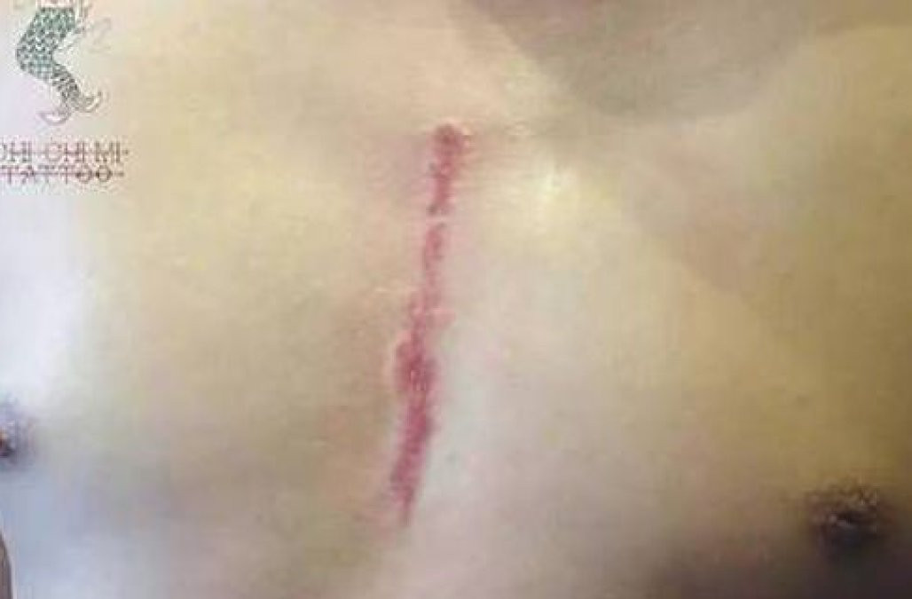 Gestul emotionant facut de un tata pentru fiul sau, suparat ca va ramane cu o cicatrice dupa ce a fost operat