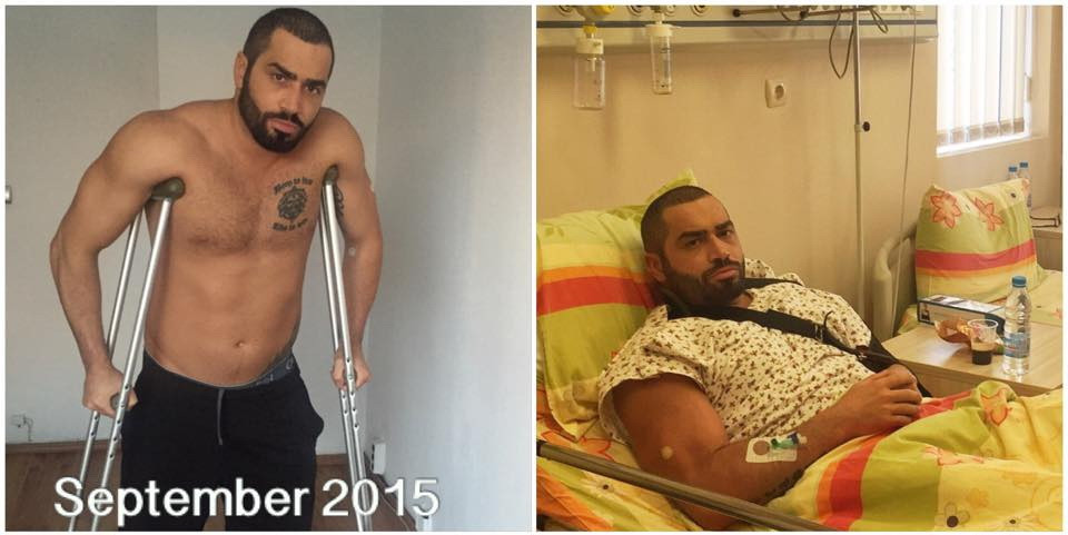 Transformarea senzationala a acestui culturist: anul trecut a suferit 4 operatii, acum arata de-a dreptul fenomenal