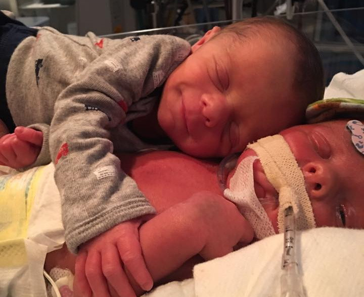 O imagine cu doi frati gemeni imbratisati a devenit virala. E tragic ce s-a intamplat dupa cateva zile