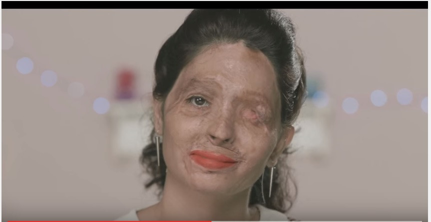 O victima a unui atac cu acid sulfuric a defilat la un eveniment monden la New York. "Nu am visat niciodata la asta"