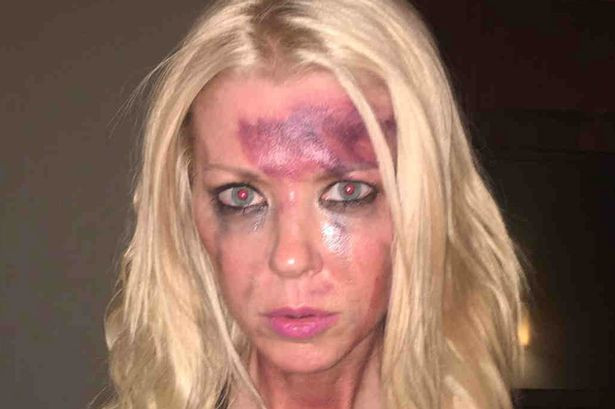 Tara Reid, batuta si plina de vanatai. Imaginile postate de actrita i-au ingrijorat pe fani. FOTO