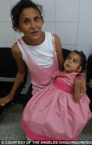 Venezuela, copii, malnutritie
