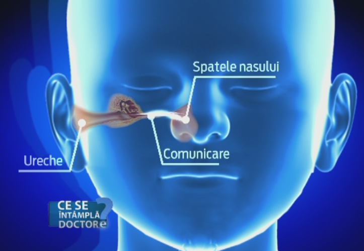 Metoda eficienta de depistare a infectiilor urechii. Cand este cazul unei interventii chirurgicale