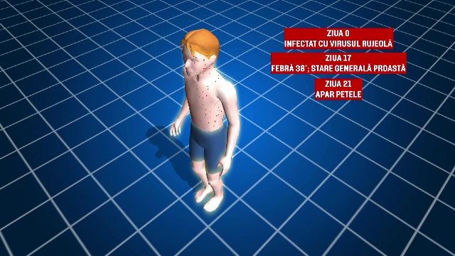 Alte 33 de cazuri noi de rujeola, in ultima saptamana. Ministerul Sanatatii recomanda vaccinarea copiilor