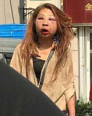 Tanara batuta cu bestialitate si abandonata apoi pe o strada aglomerata, dupa ce a fost prinsa cu amantul de sotia inselata