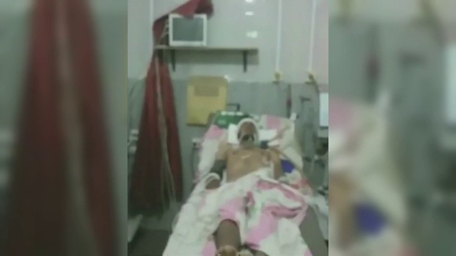 Copii raniti de bombe operati direct pe podea in spitalele din Alep. Semnalul de alarma tras de comunitatea internationala.