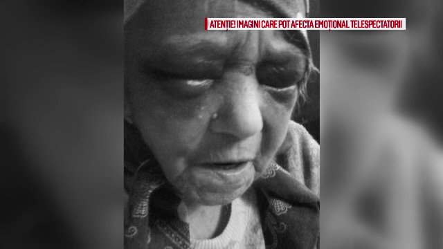 Ancheta a politiei, dupa ce poze cu o batrana de 90 de ani batuta crunt au fost postate pe Facebook. Cine ar fi agresorul