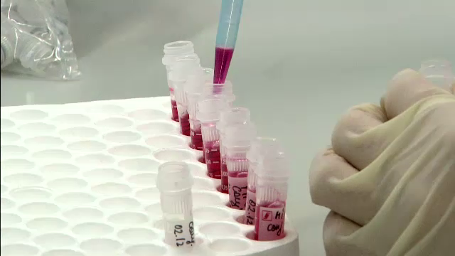 Ancheta la spitalul din Craiova, dupa ce sase pacienti au fost infectati cu o bacterie ucigasa. "Ne este frica"