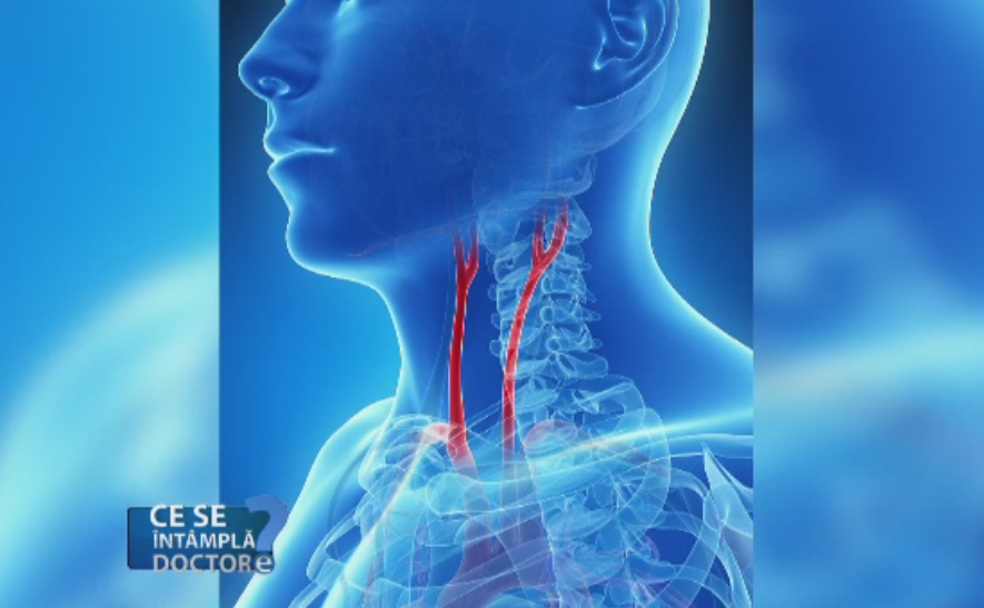 Importanta ecografiei de carotida. Bifurcatia extrem de sensibila este agresata la fiecare bataie a inimii