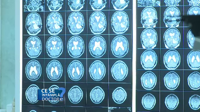 neurologie