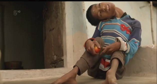 Viata unui copil de 13 ani a fost un calvar. Motivul pentru care vedea pe toata lumea invers si cum i s-a schimbat viata