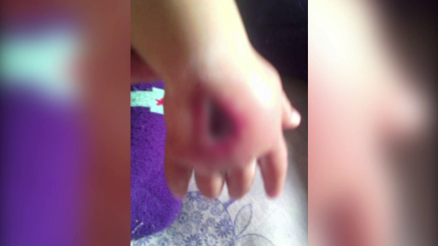 Bebelus ranit grav, dupa ce i s-ar fi pus gresit o branula: "Vine la spital bolnav si pleaca cu gaura in mana. Nu e normal!"