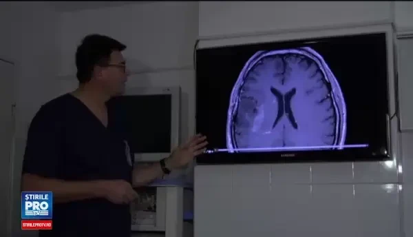 Tehnologia preluata din aviata militara salveaza vieti si in Romania. Cinci pacienti cu tumori pe creier, operati cu succes
