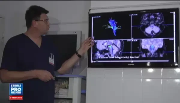 Tehnologia preluata din aviata militara salveaza vieti si in Romania. Cinci pacienti cu tumori pe creier, operati cu succes