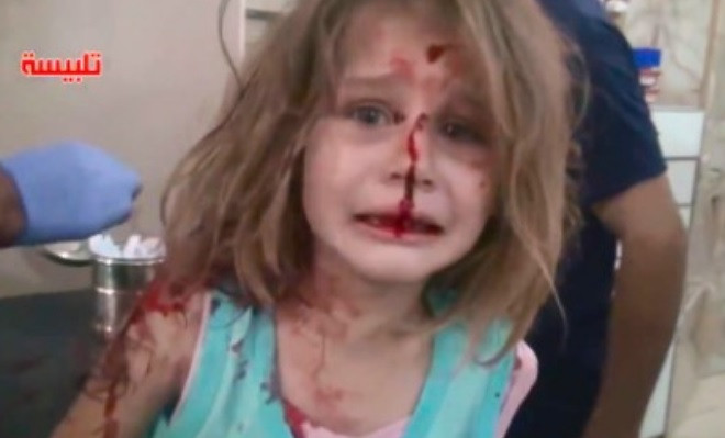 Fetita ranita in bombardamentele din Siria isi cauta cu disperare tatal. Imaginea are un puternic impact emotional