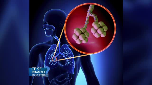 Fumul de tigara versus noxele emise de masini: care este cel mai periculos pentru plamani