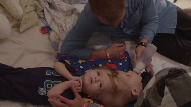 Doi parinti americani au trait cele mai dificile momente. Gemenii lor, lipiti in zona capului, au fost operati cu succes