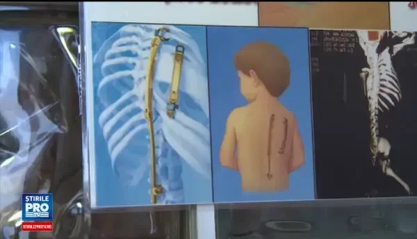 Ana s-a nascut fara o parte din piciorul drept si cu malformatii la coloana. Fetita are nevoie de ajutor pentru operatie