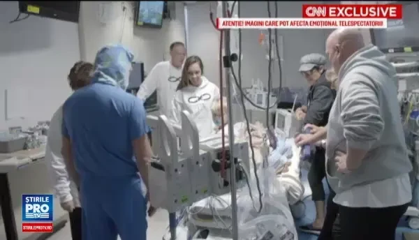 Povestea siamezilor din Chicago, Statele Unite, care s-au nascut lipiti in zona capului. Cum a decurs operatia