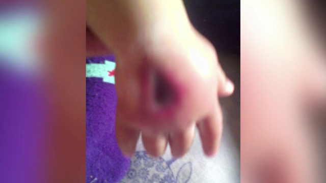 Bebelusul ars la mana din cauza unei branule montate gresit a fost operat. Pedepsele pe care le risca cei vinovati