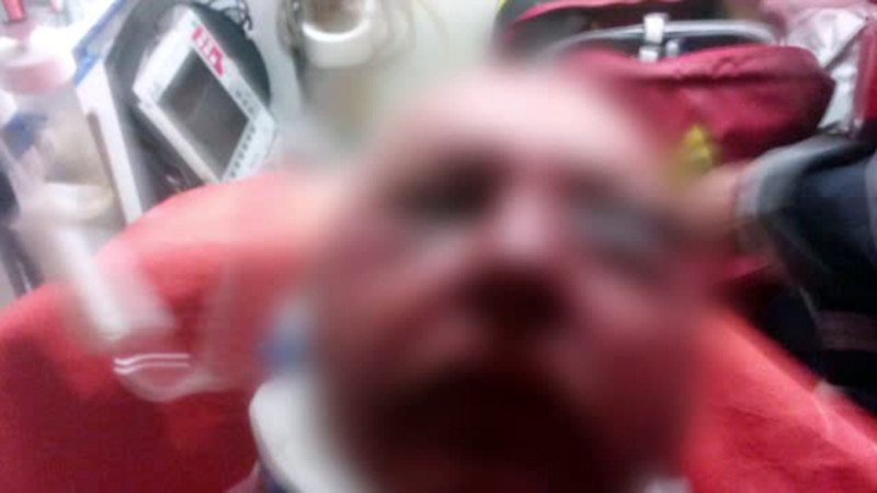 Batut cu salbaticie din cauza ca nu a lasat oile pe pamantul sau. "Ne-au distrus vietile, ne-au nenorocit"