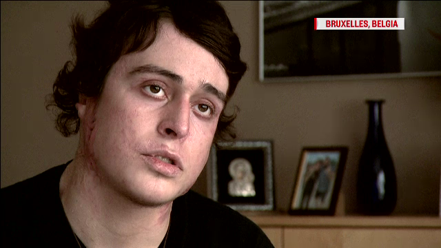 UN AN DE LA COLECTIV. Pavlos si-a salvat prietenul, dar a ramas mutilat: "Vreau o viata normala! Sper ca nu cer mult!"