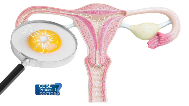 "Am luat medicamente fara sa tin cont ca sunt insarcinata". Dupa cat timp de la formarea embrionului poate deveni o problema