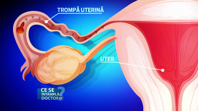 aparat genital feminin