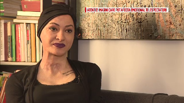 Povestea lui Tedy, pasarea Phoenix din Colectiv, data afara din spitalul AKH din Viena: "Aveam bandaj de 6 cm grosime"