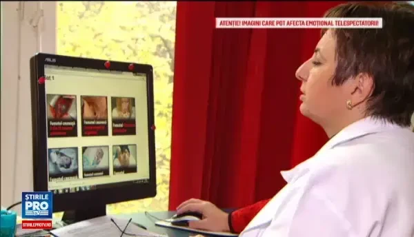 Imagini si mai socante pe pachetele de tigari, din 2017. Care vor fi noile poze si mesaje