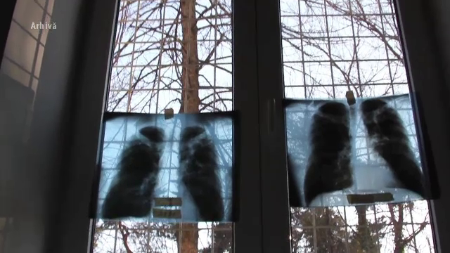 O profesoara din Galati a declansat un focar de tuberculoza la scoala, iar 360 de elevi vor fi testati. Ce au decis parintii