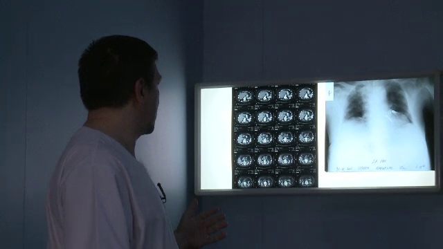 Sistemul de Sanatate, lovit de un nou scandal. De ce nu se pot face operatii la Centrul de Transplant de Plamani Sf. Maria