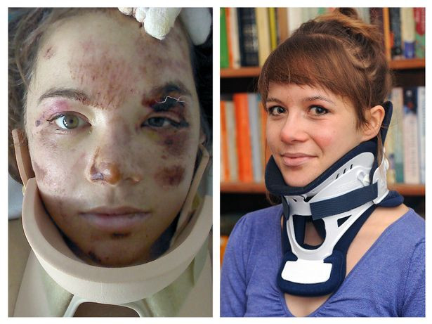 O alpinista britanica a cazut peste 180 de metri de pe Vf. Moldoveanu. Cum arata femeia care a suferit 2 hemoragii FOTO