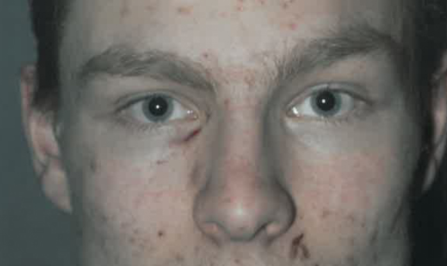 Condamnat la inchisoare pe viata pentru ca si-a ucis bunica si matusa. Tanarul de 21 era dependent de cannabis